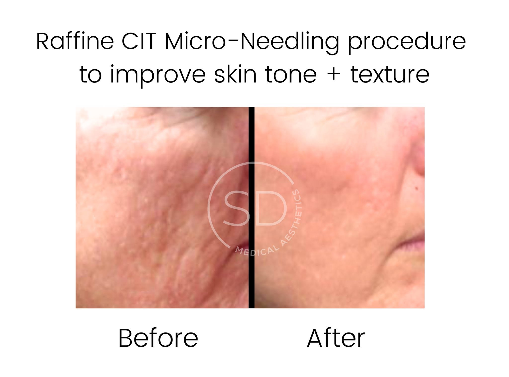 Real skin journey 3 at Caring Touch Aesthetics