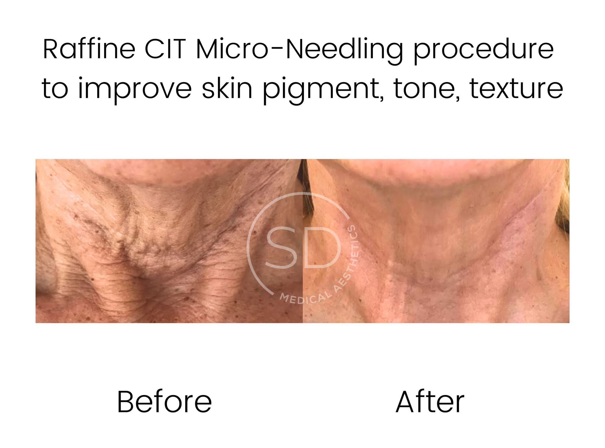 Real skin journey 2 at Caring Touch Aesthetics