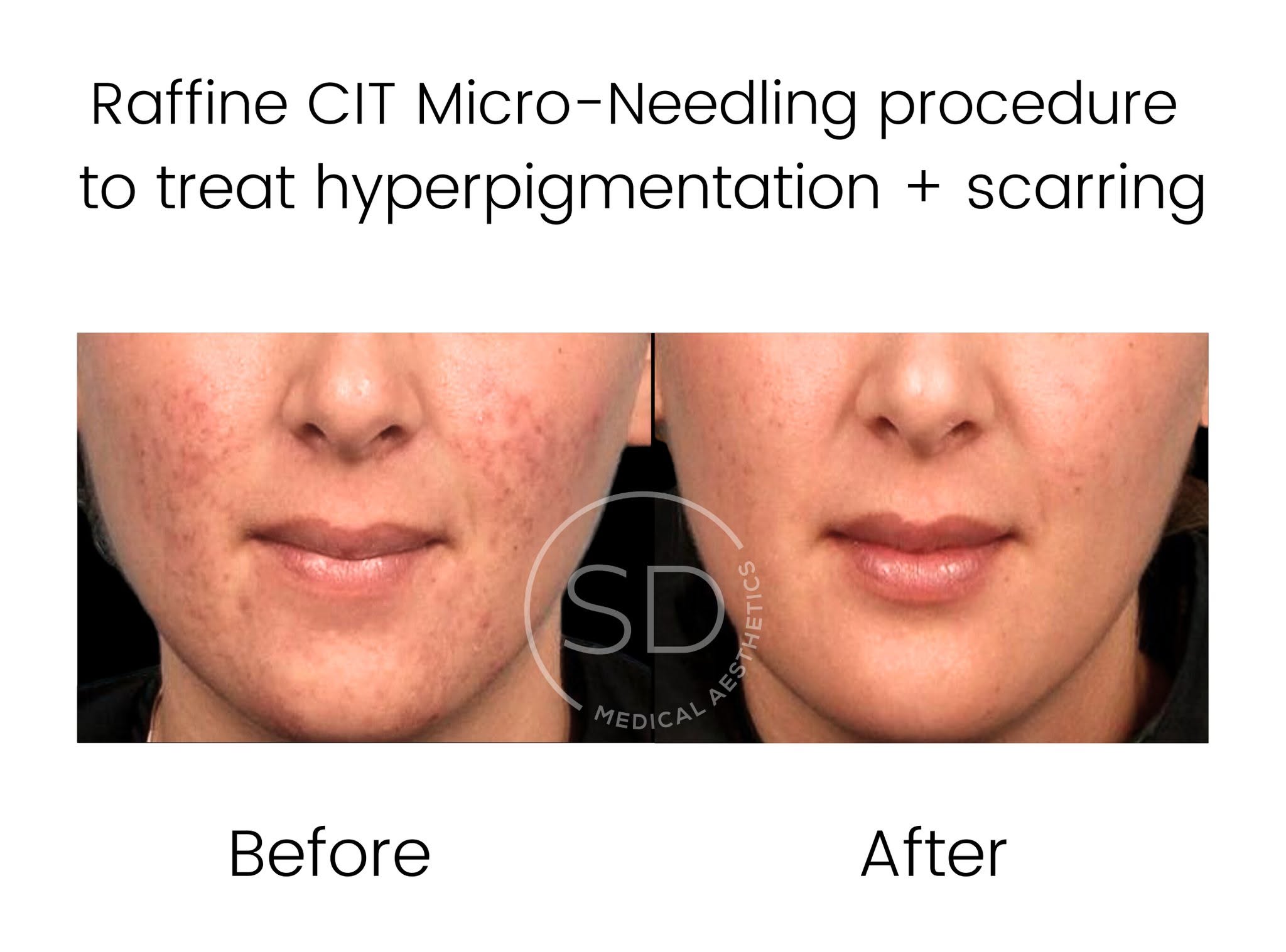 Real skin journey 1 at Caring Touch Aesthetics