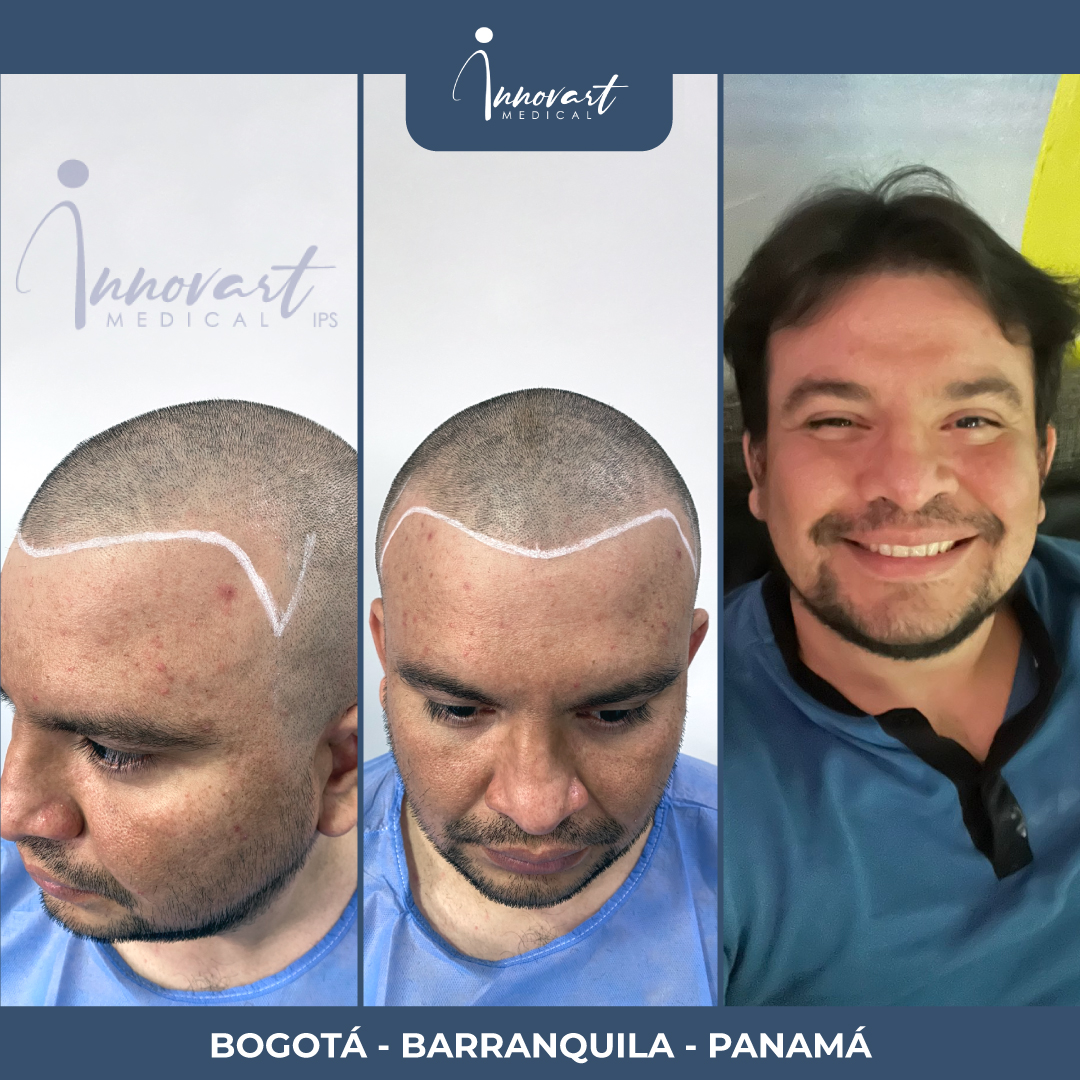 Caso de éxito Innovart