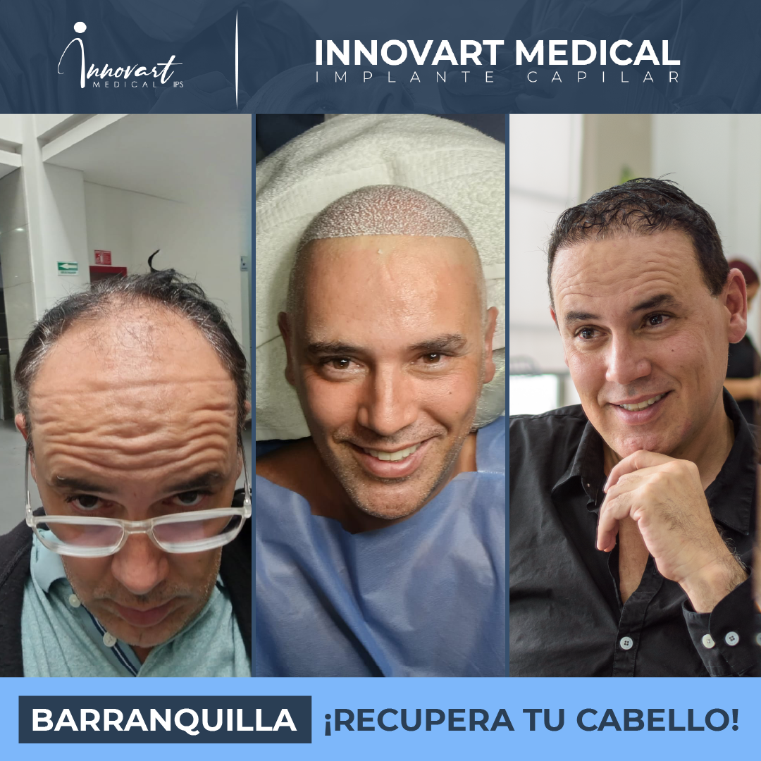 Caso de éxito Innovart
