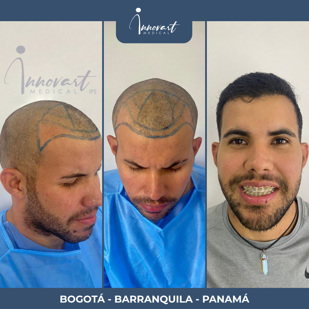 Caso de éxito Innovart
