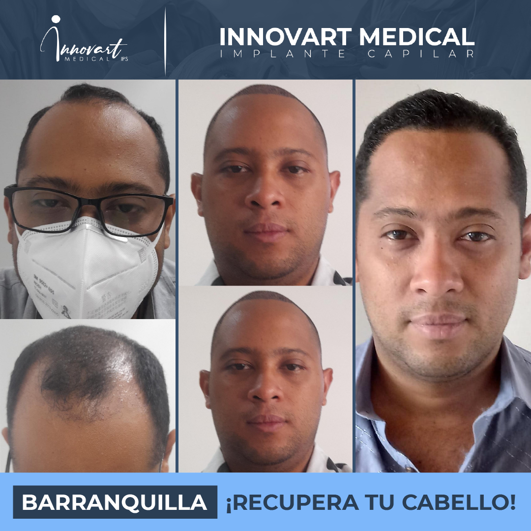Caso de éxito Innovart