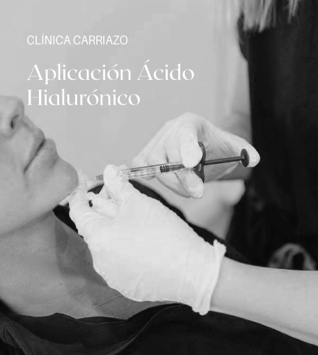 fillers en barranquilla clinica carriazo