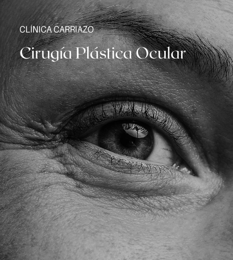 cirugía de párpados en barranquilla clinica carriazo