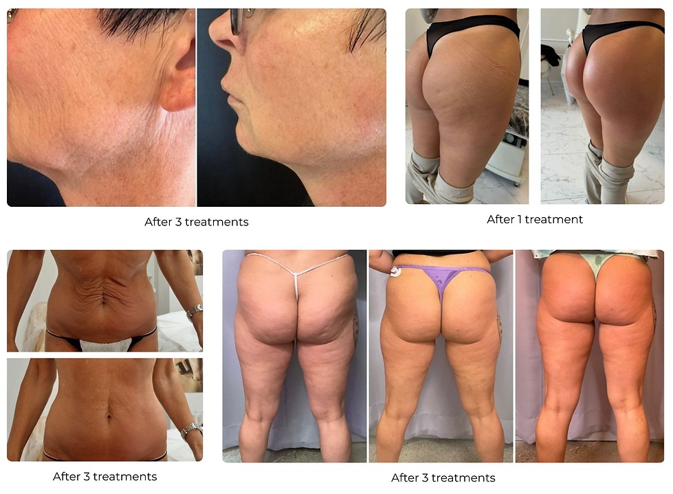 Collage of T-Shape 2 before and after results