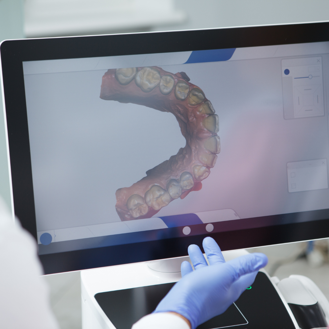 Advanced dental technology