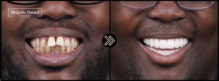 Bespoke Dental team