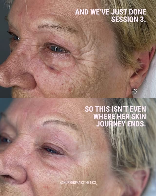 Skin Treatments result