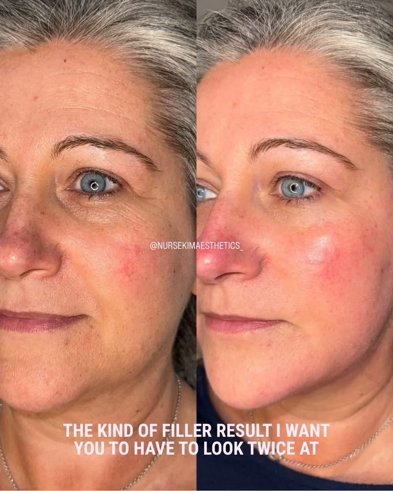 Facial Profiling result