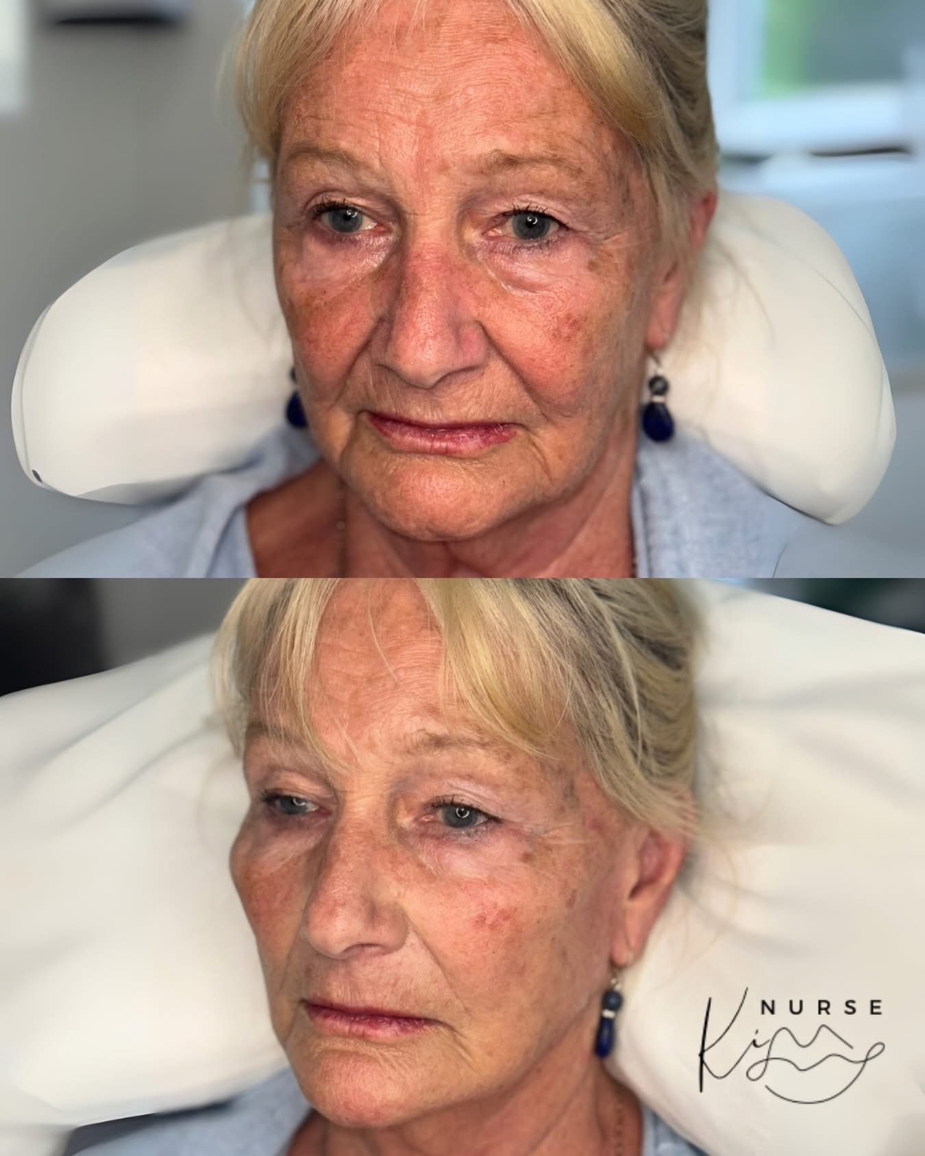 Facial Profiling result
