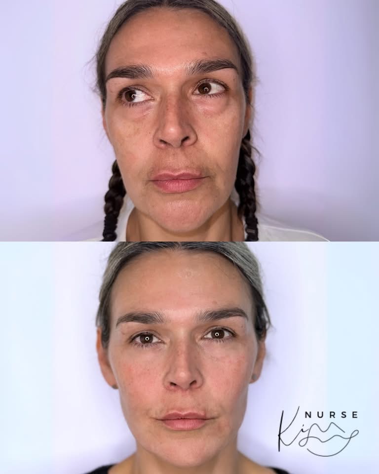 Facial Profiling result