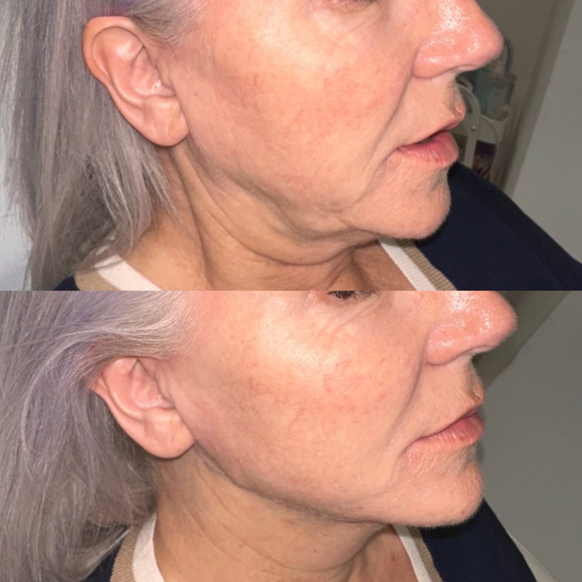 Facial Profiling result