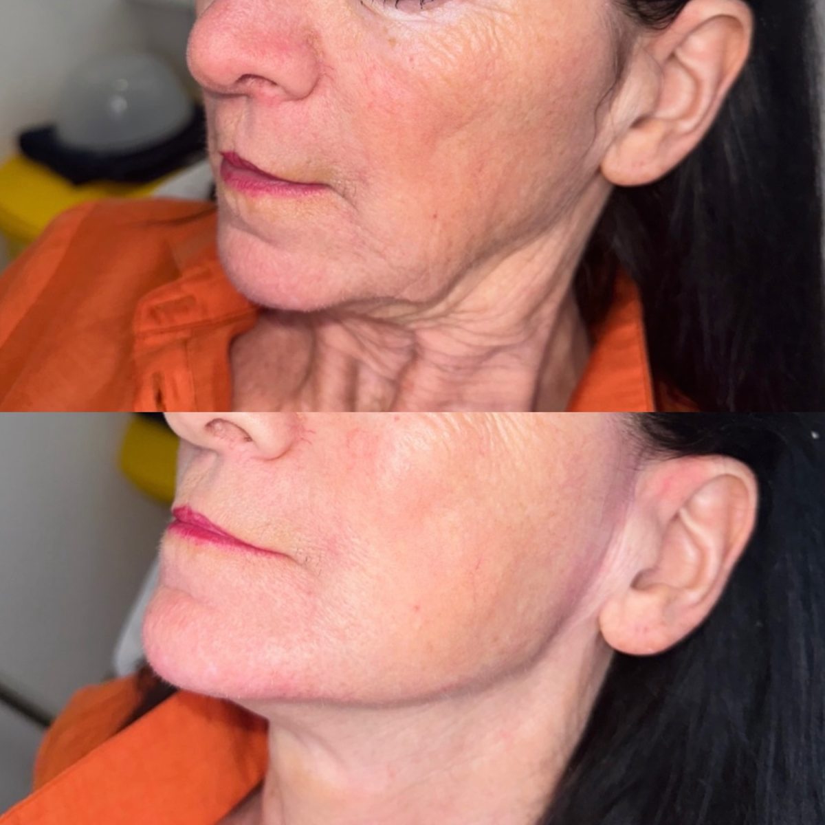 Facial Profiling result