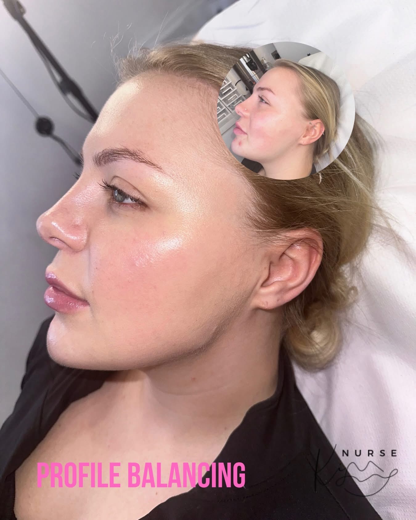 Facial Profiling result