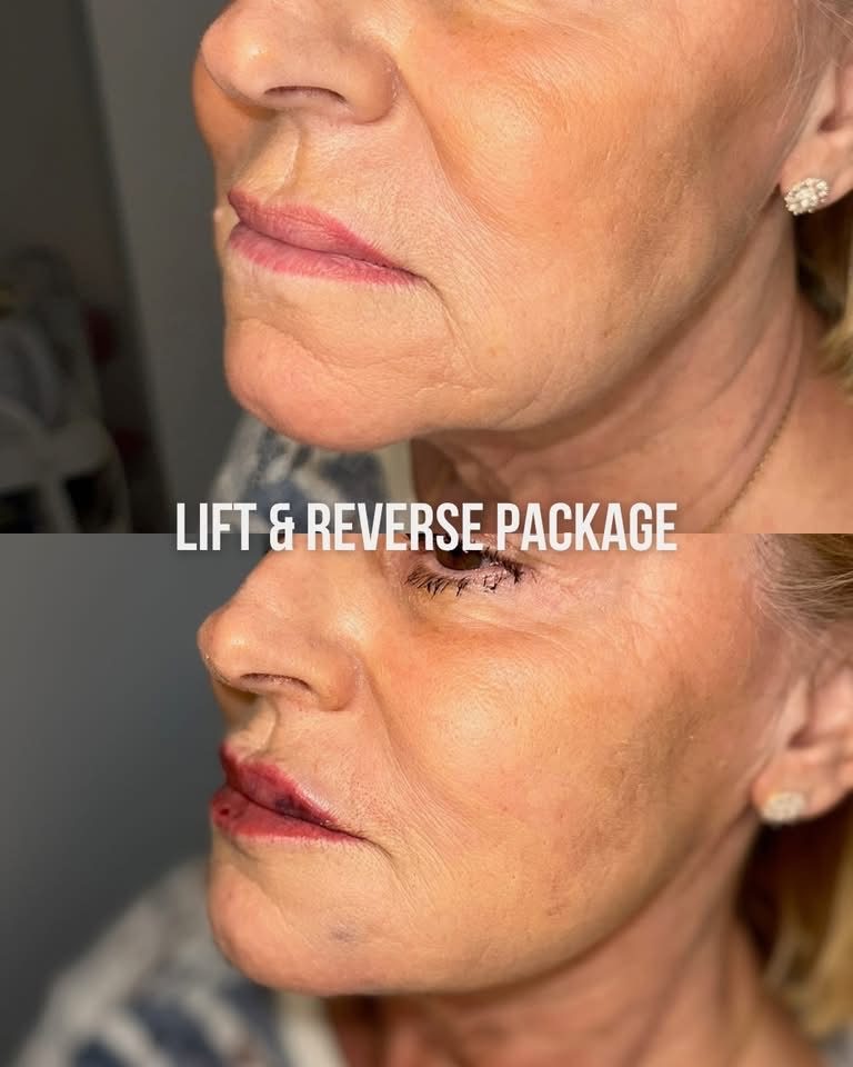 Facial Profiling result