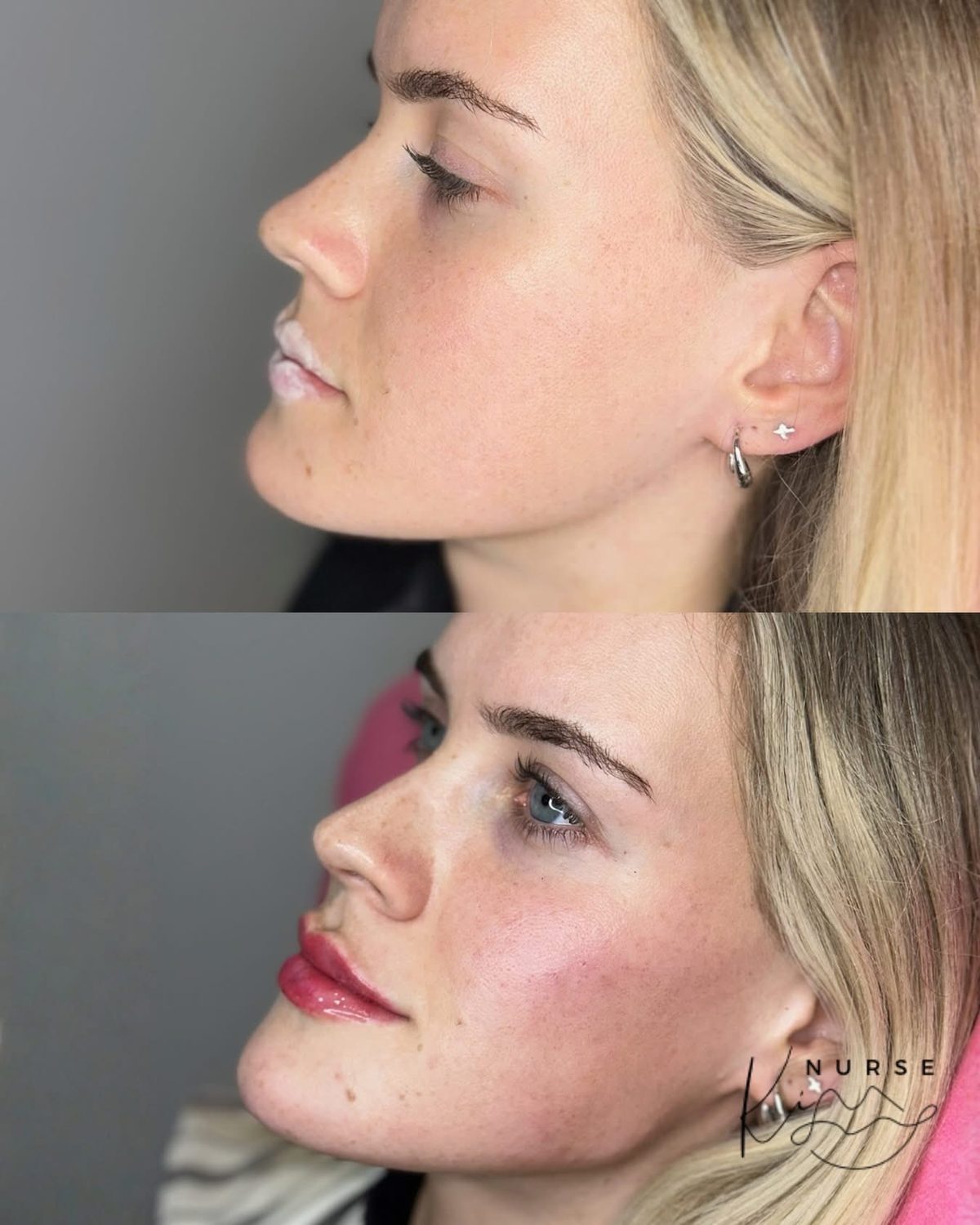 Facial Profiling result