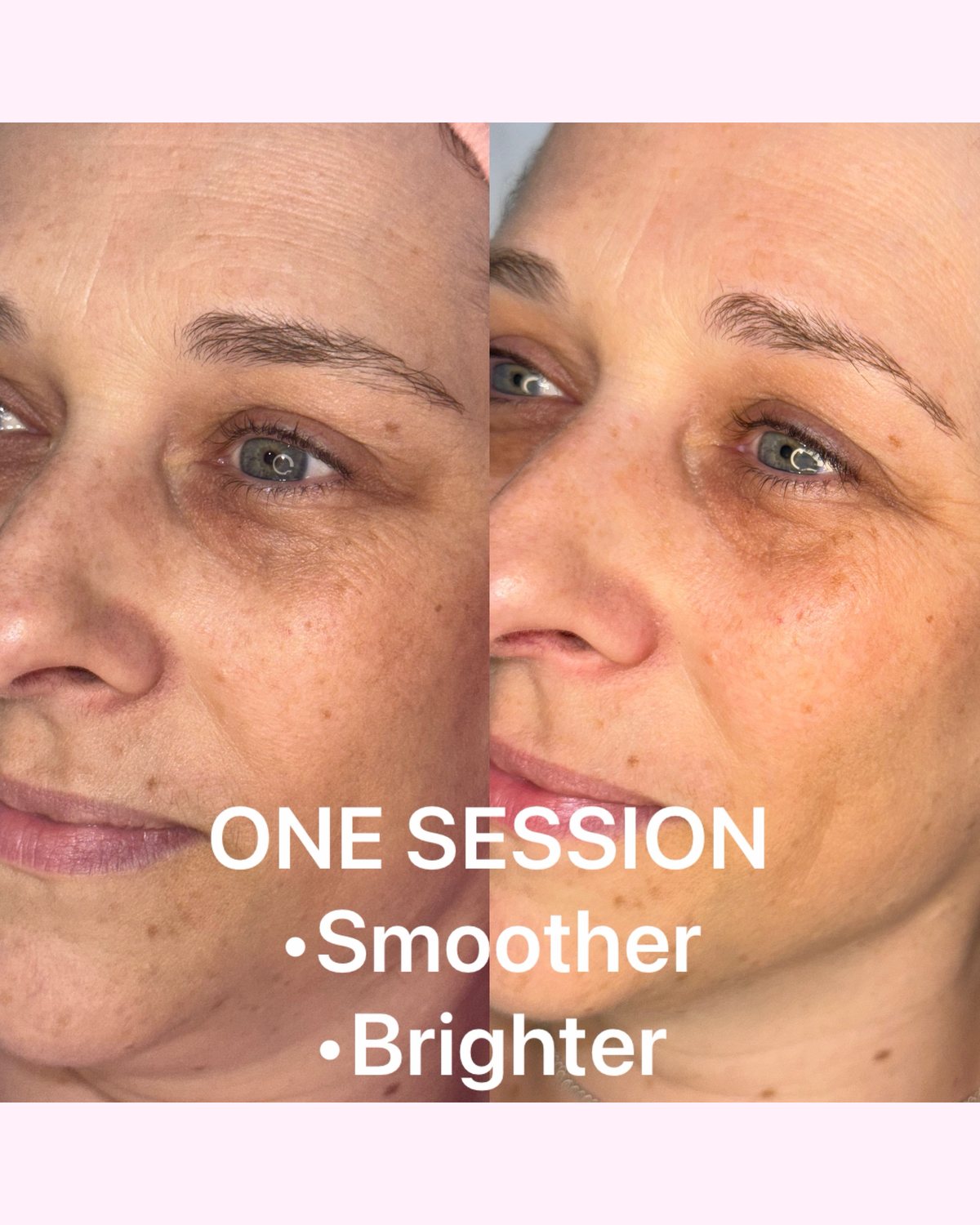Skin Treatments result