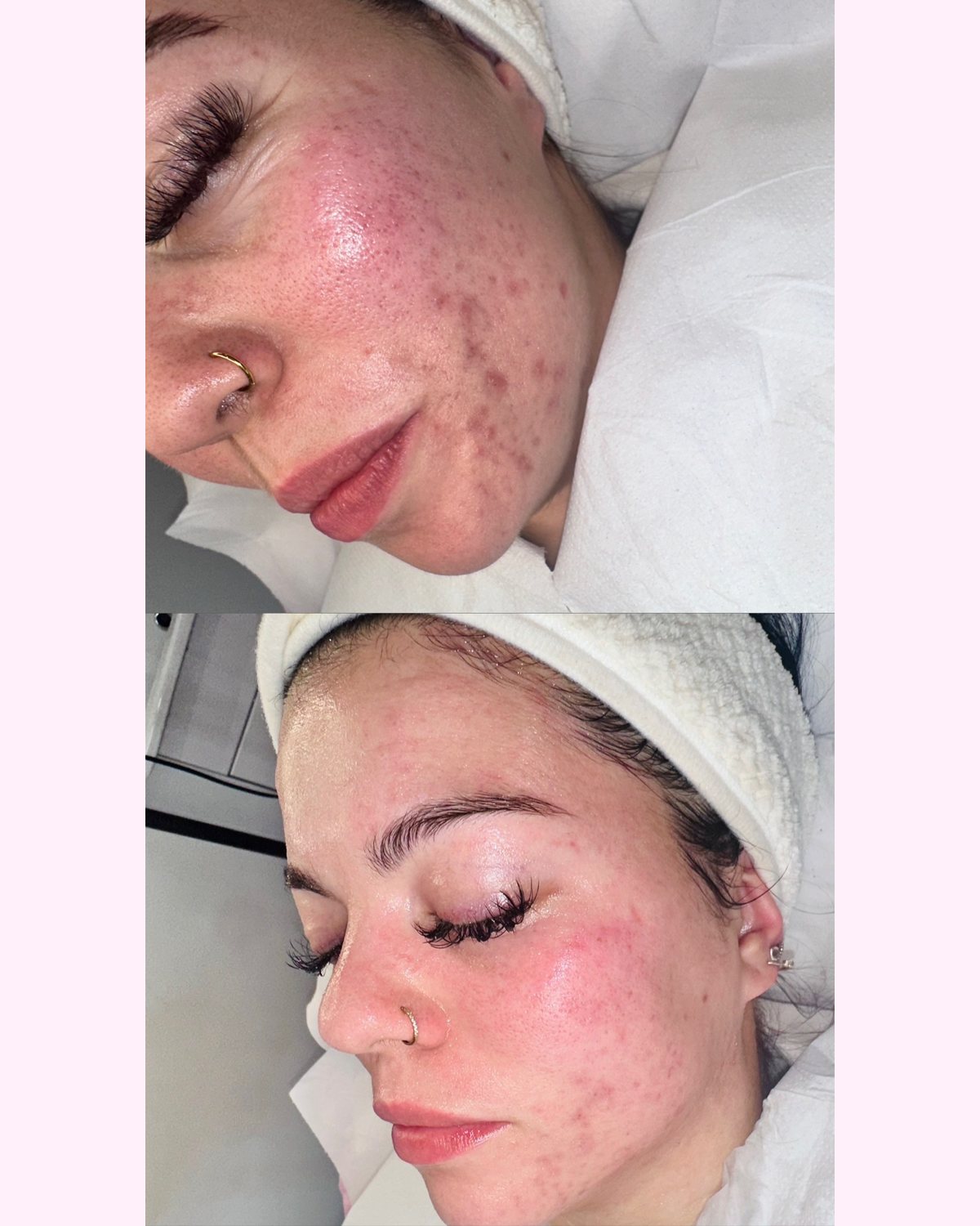 Skin Treatments result