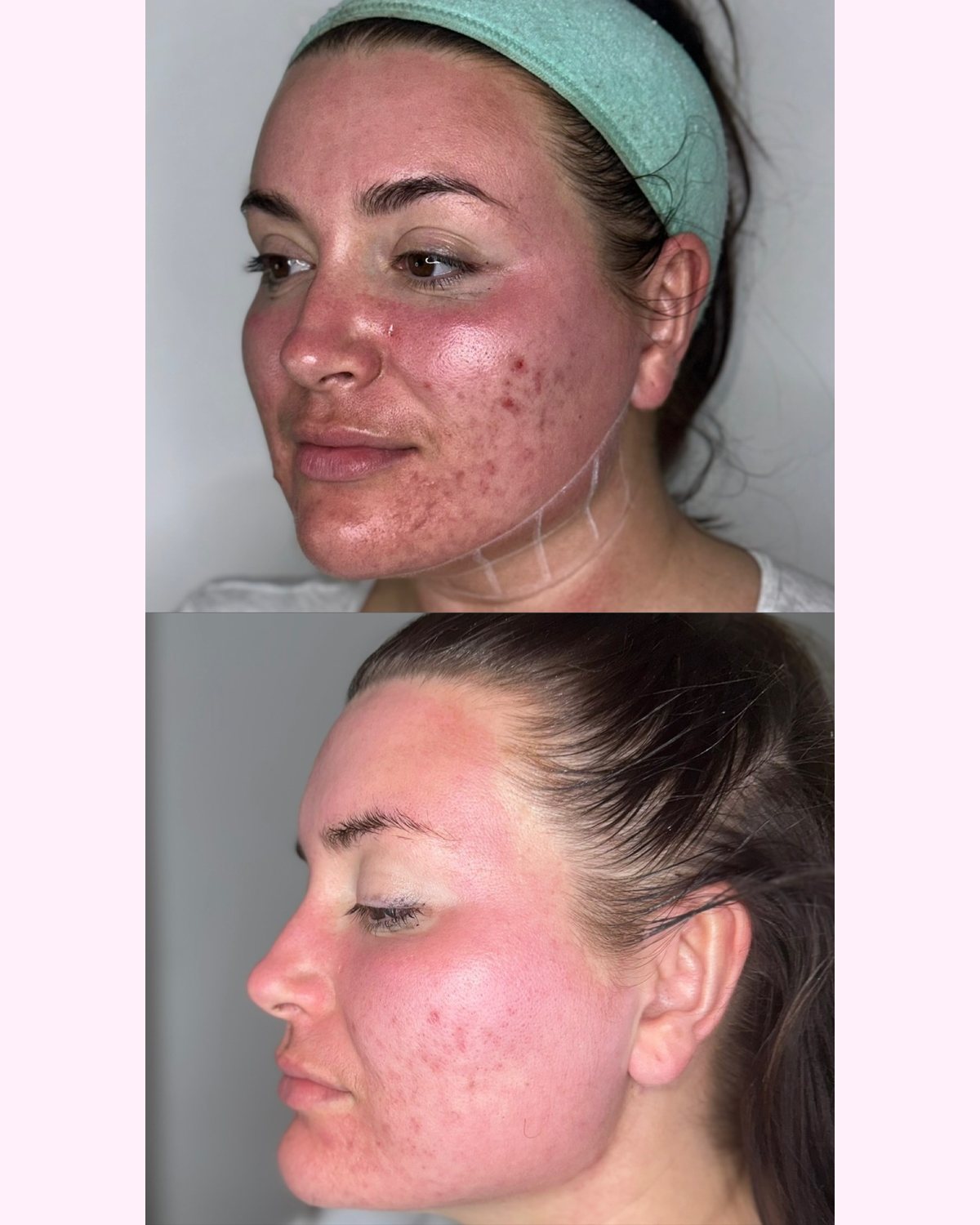 Skin Treatments result