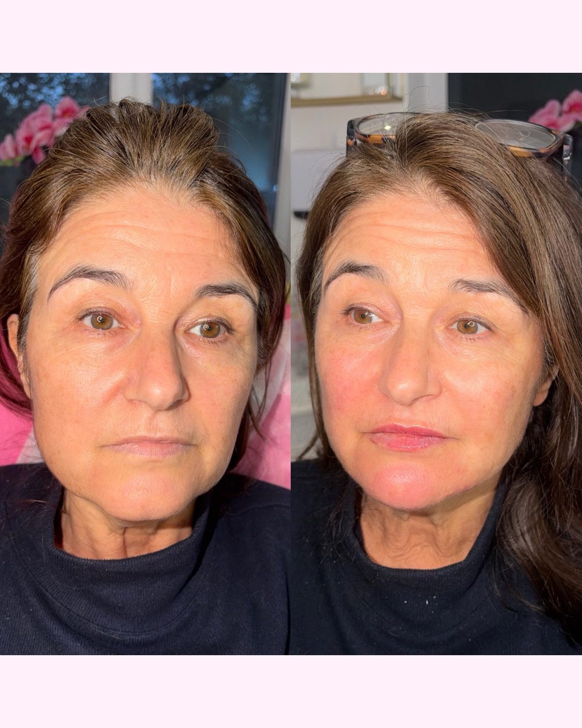 Facial Profiling result