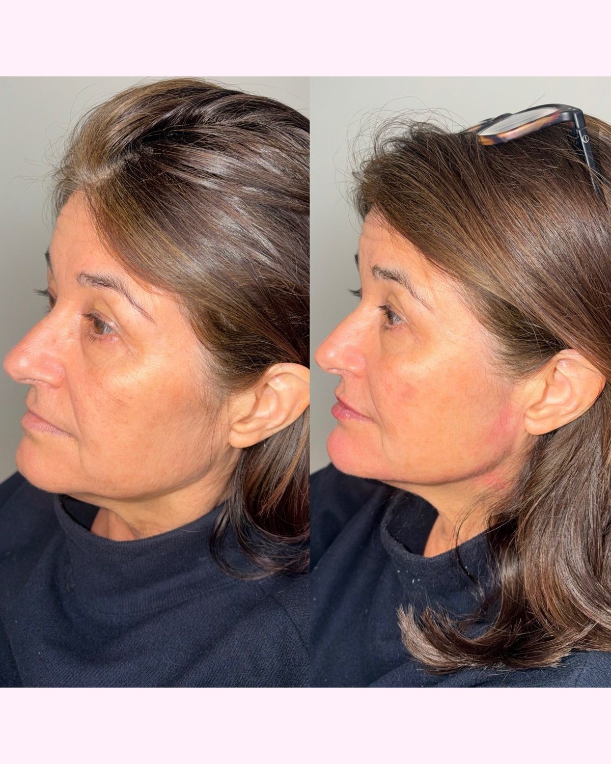 Facial Profiling result