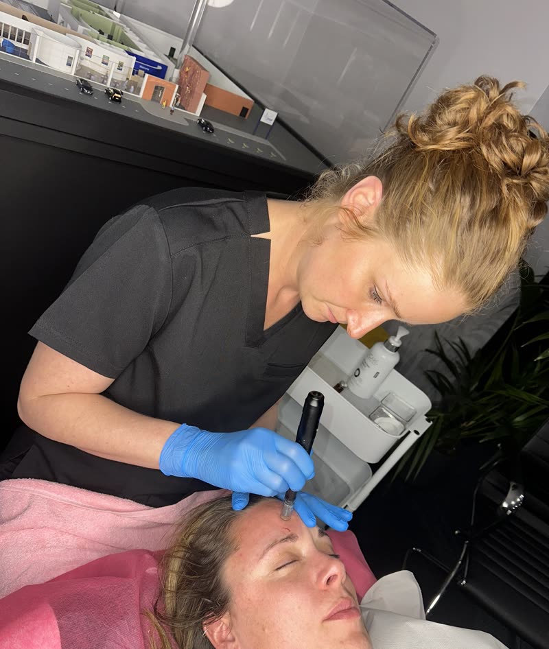 Jessica practising microneedling on a model