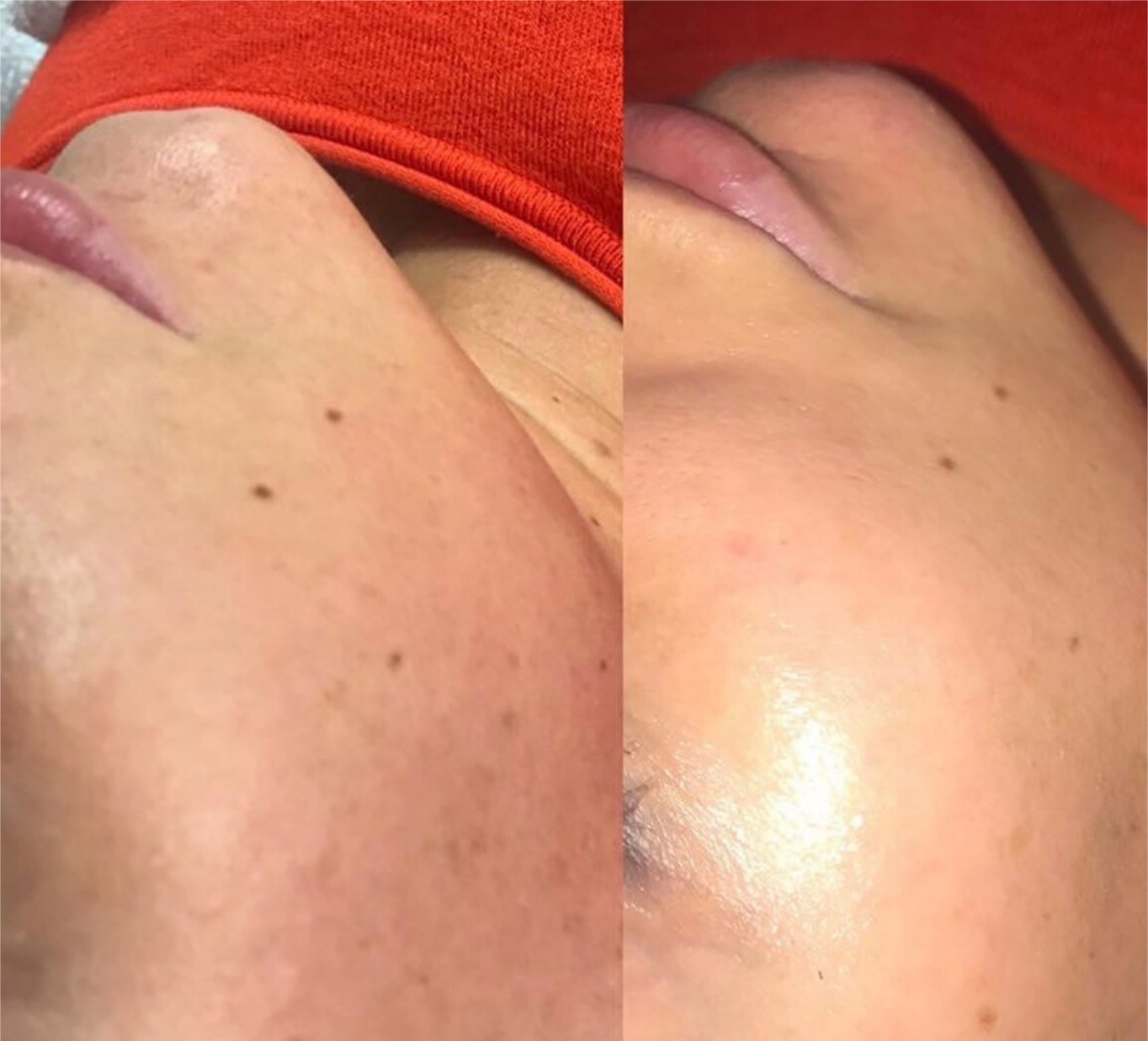 Glow Getter result