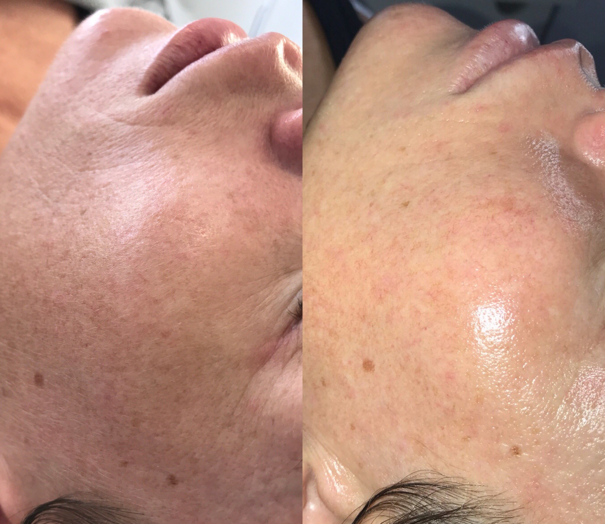 Glow Getter result