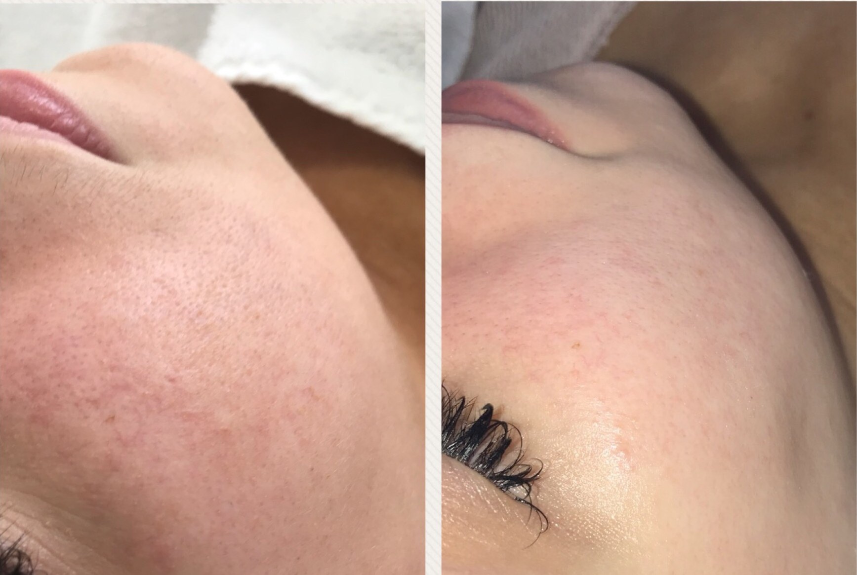 Glow Getter result