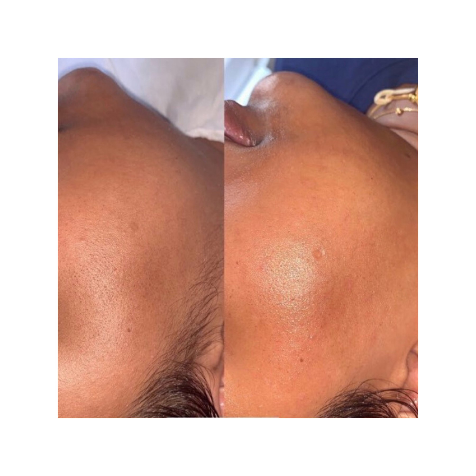 Glow Getter result