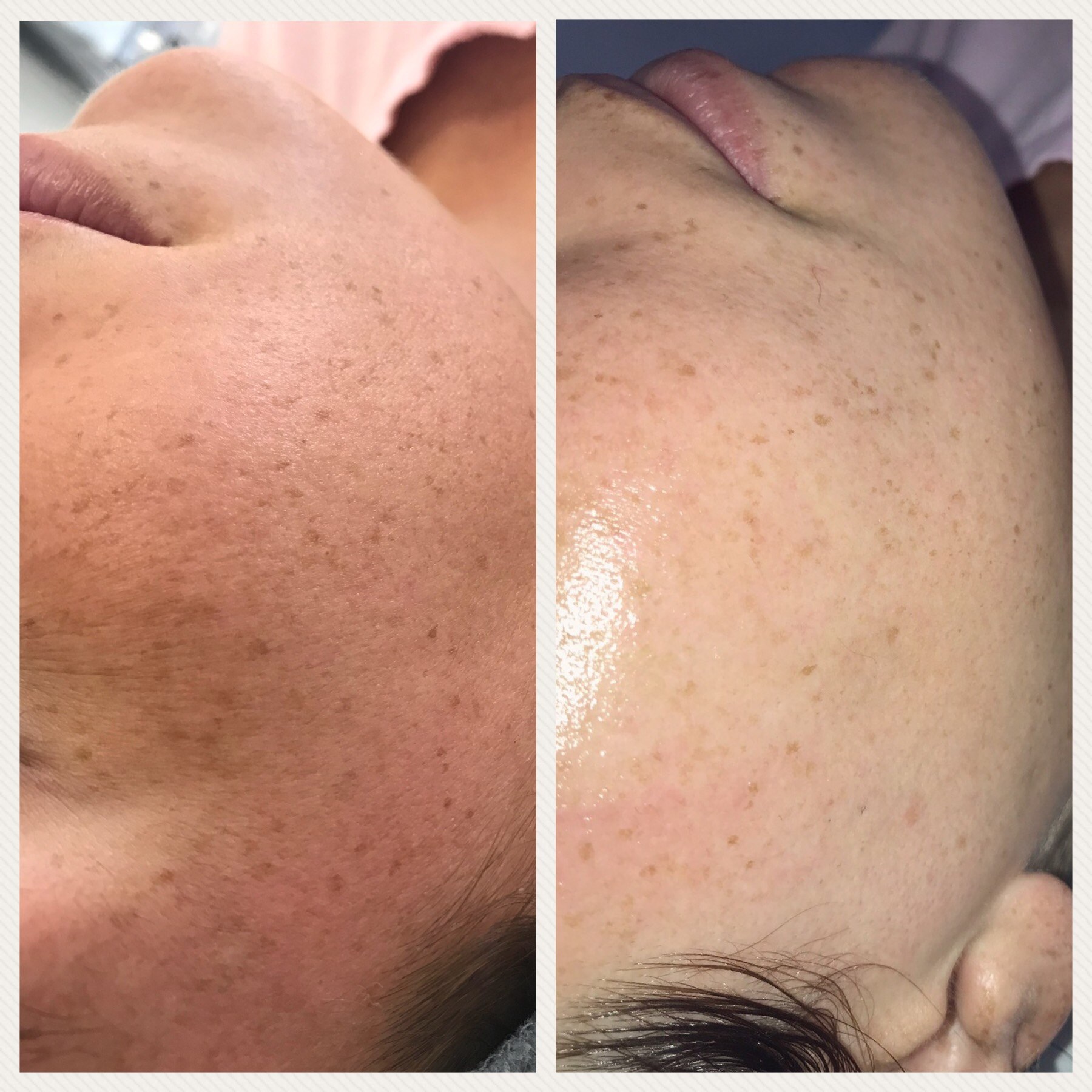 Glow Getter result