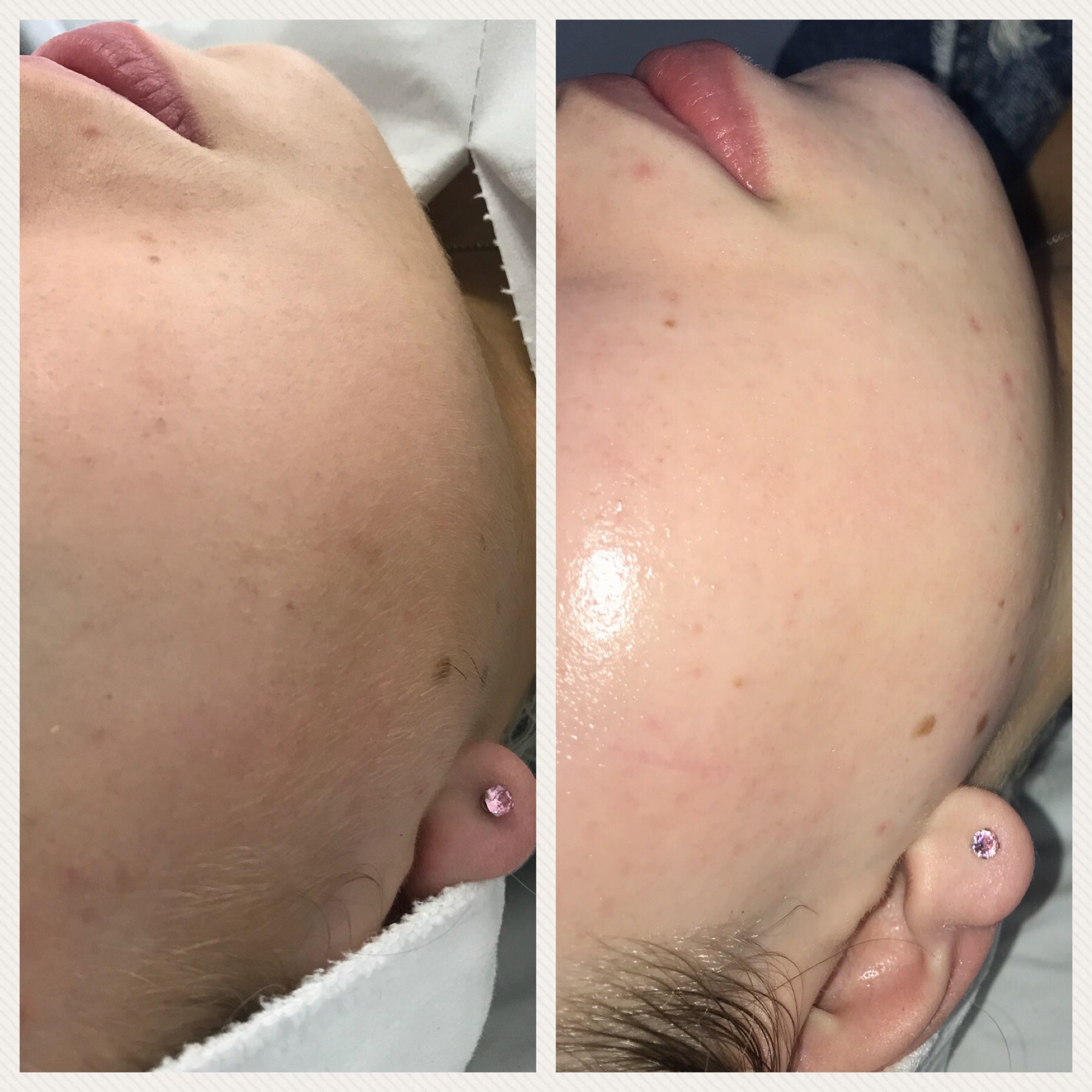 Glow Getter result