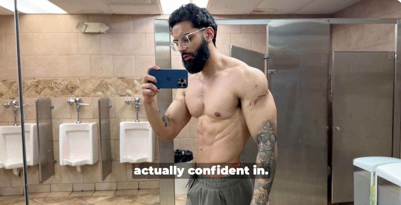 After surgery: lean, muscular, and confident again