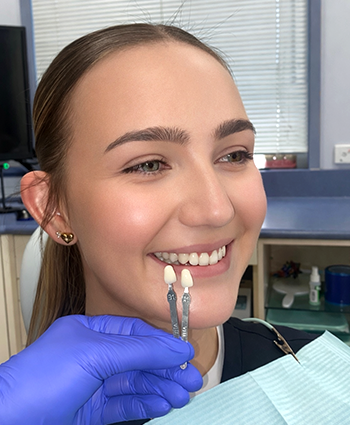 Porcelain and Composite Veneers