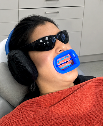 In-Chair and Take-Home Teeth Whitening