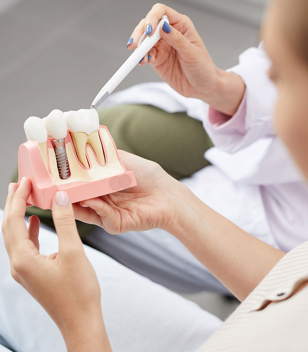 Dental Implants