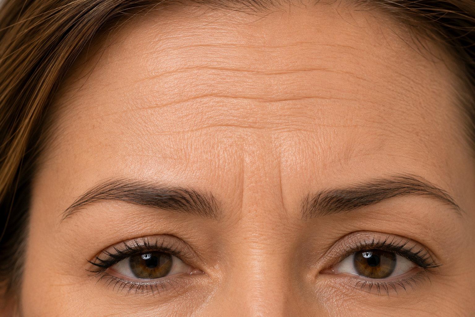 Common signs of aging skin and forehead wrinkles Common signs of aging skin and forehead wrinkles