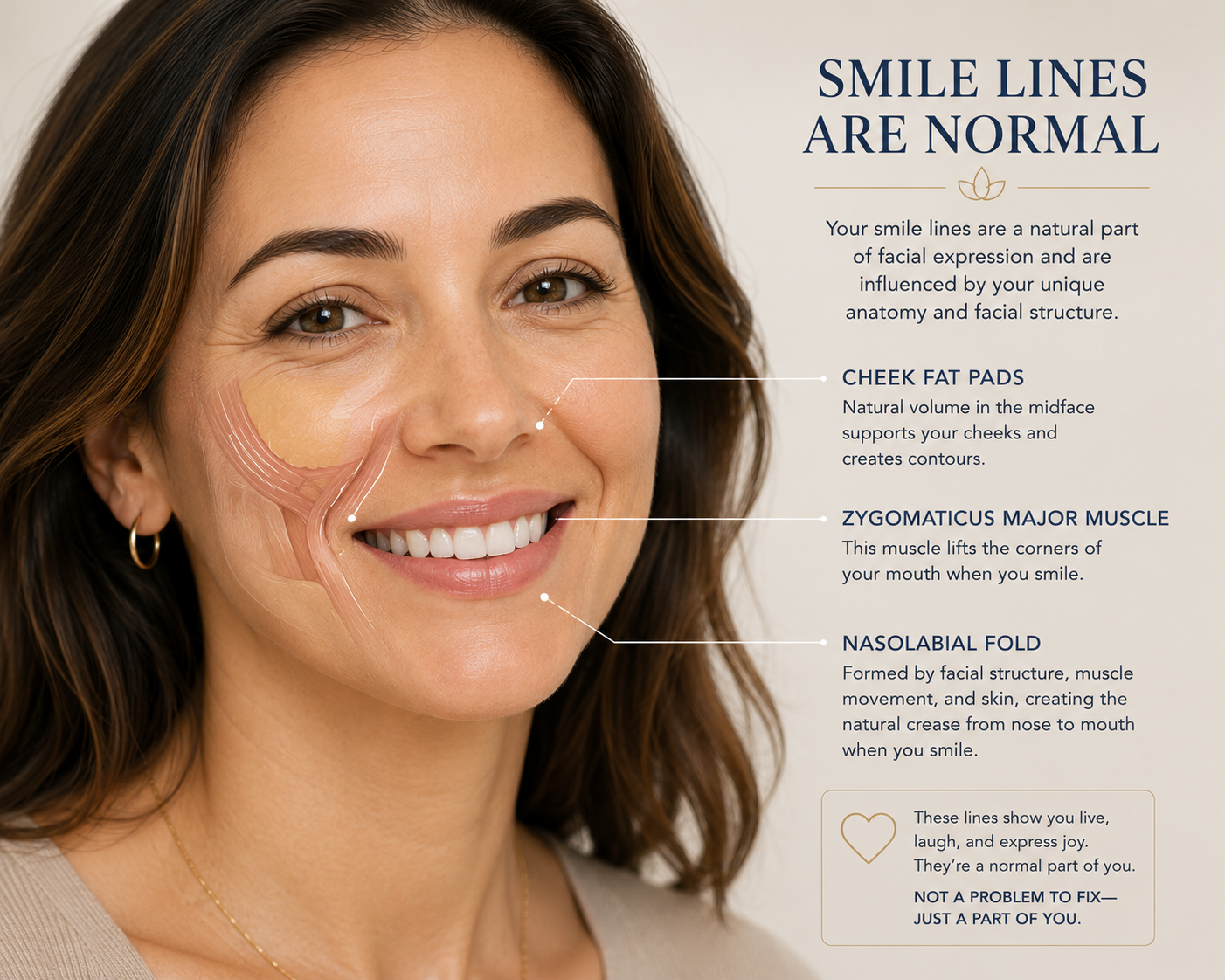 Natural smile showing how facial movement affects nasolabial folds Natural smile showing how facial movement affects nasolabial folds