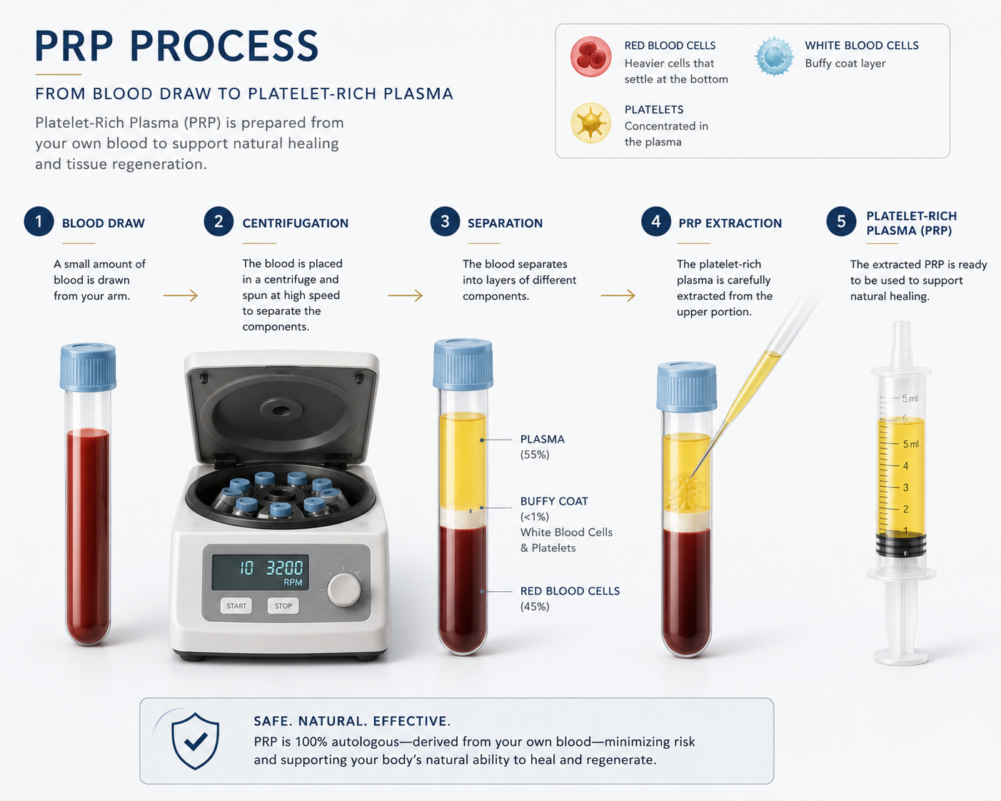 Illustration showing how Platelet-Rich Plasma is prepared for skin rejuvenation Illustration showing how Platelet-Rich Plasma is prepared for skin rejuvenation