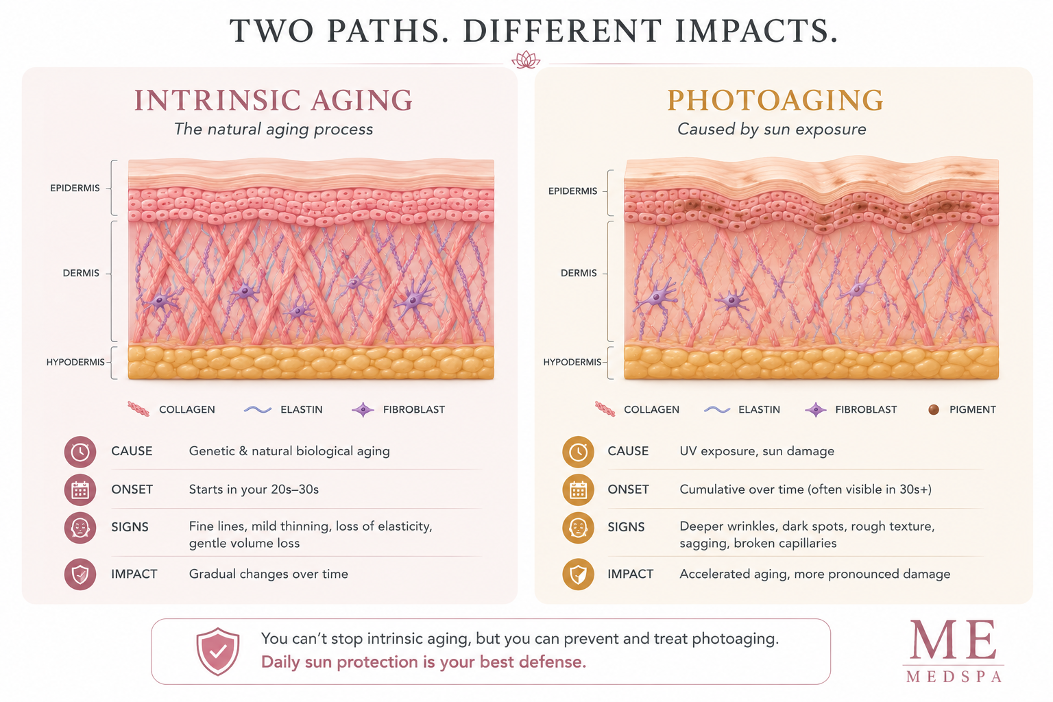 Comparison illustrating natural aging and photoaging caused by ultraviolet exposure