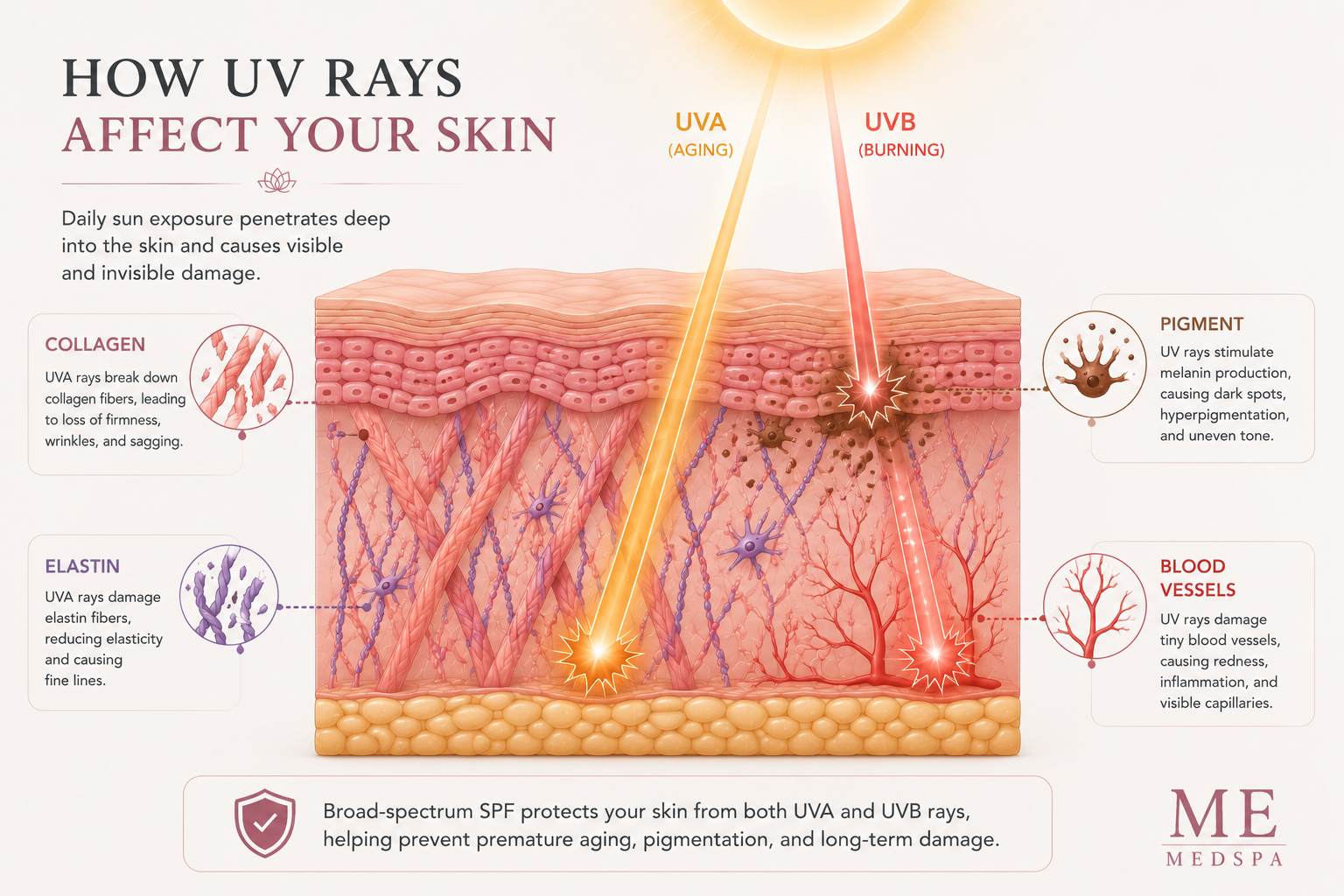 Illustration showing how ultraviolet exposure contributes to photoaging