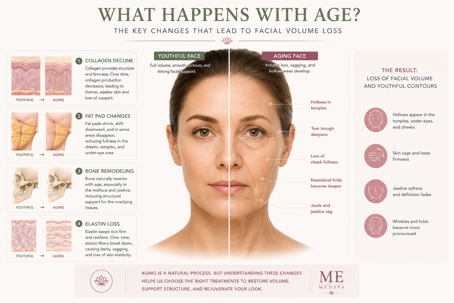 Infographic illustrating the primary causes of facial volume loss with age
