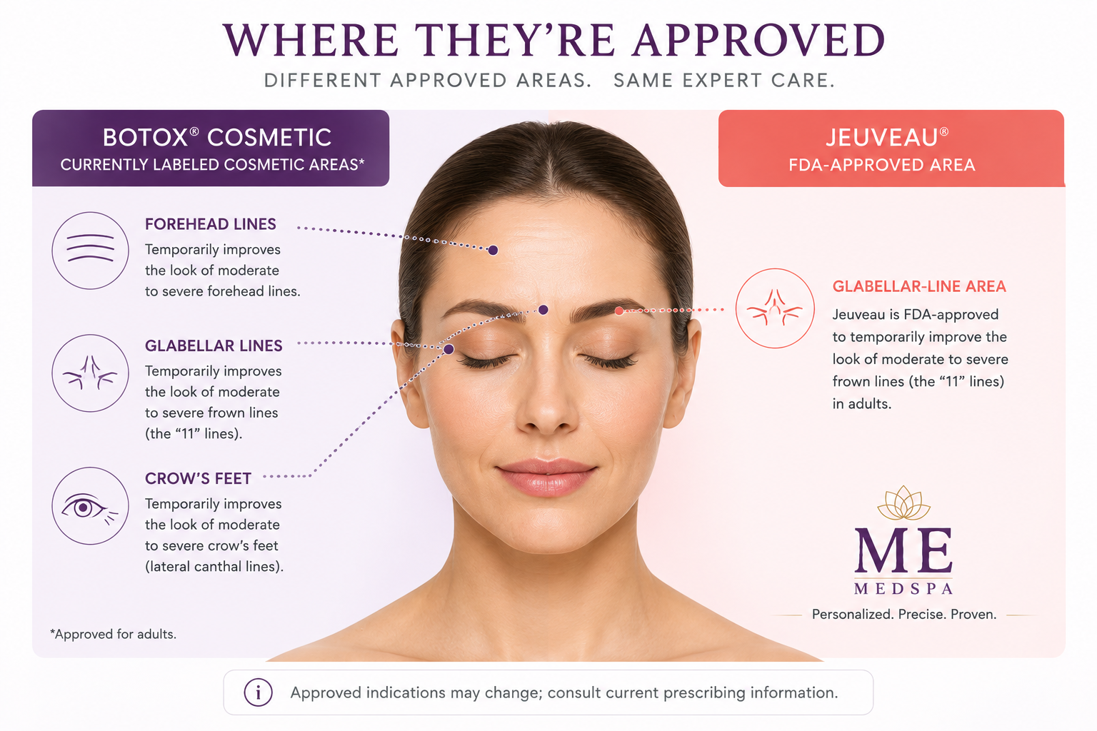   Educational face map comparing FDA-approved cosmetic treatment areas for Botox and Je