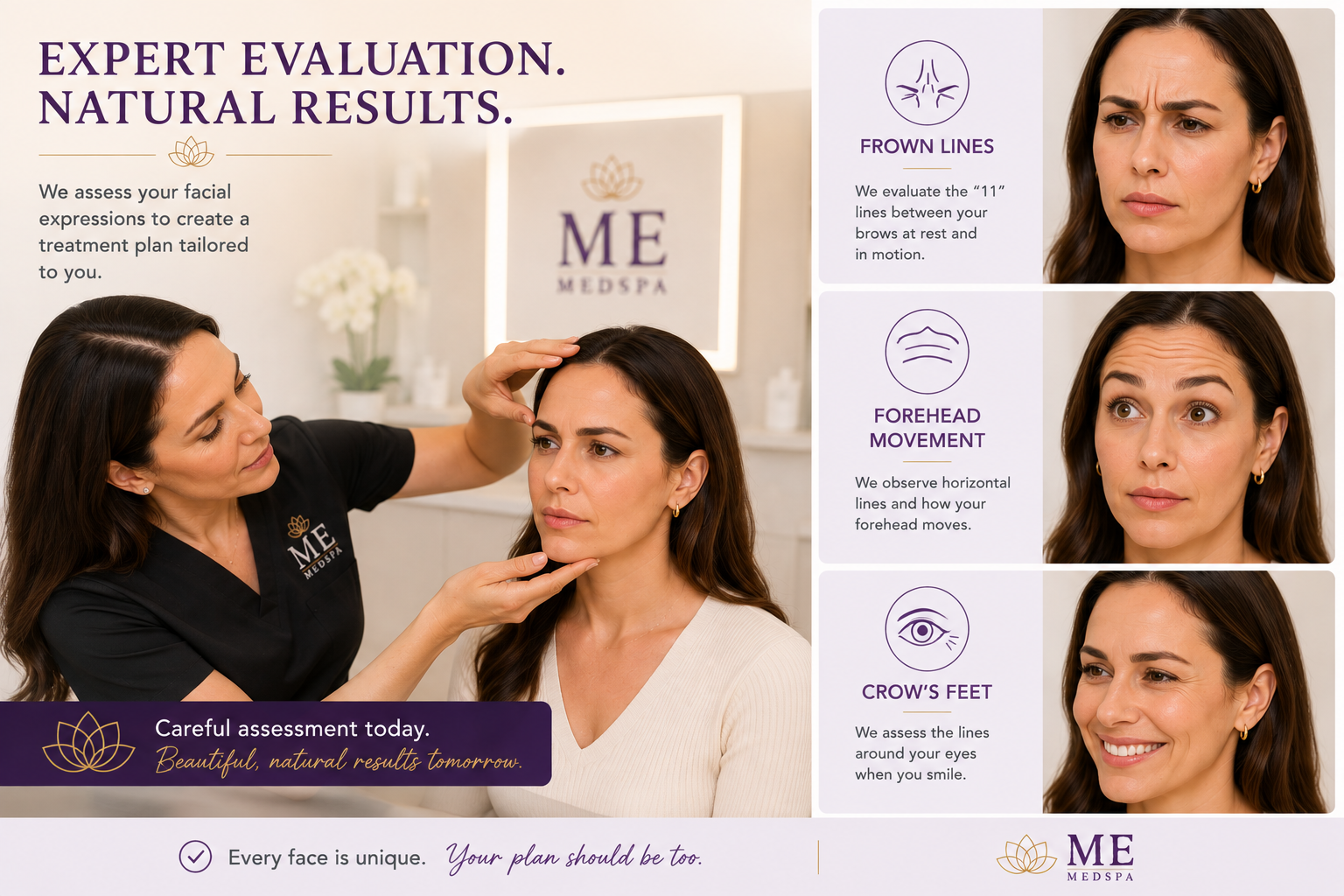 Provider evaluating dynamic facial wrinkles before a Botox consultation