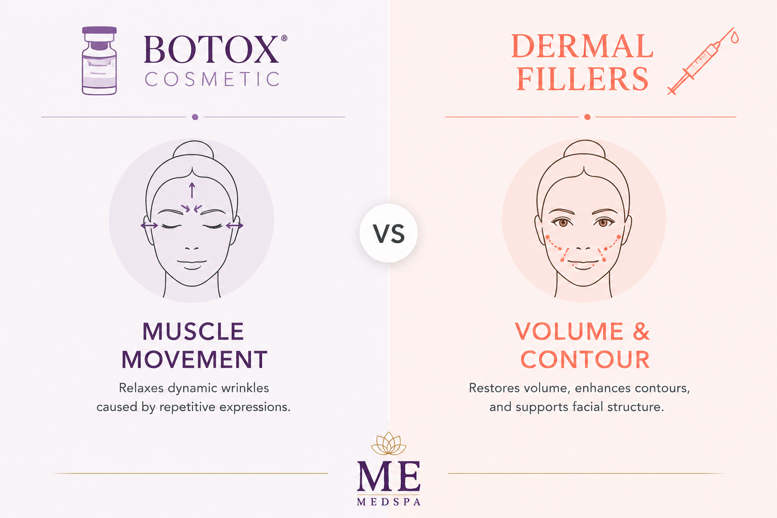 Comparison showing Botox for muscle-related wrinkles and fillers for facial volume and contour