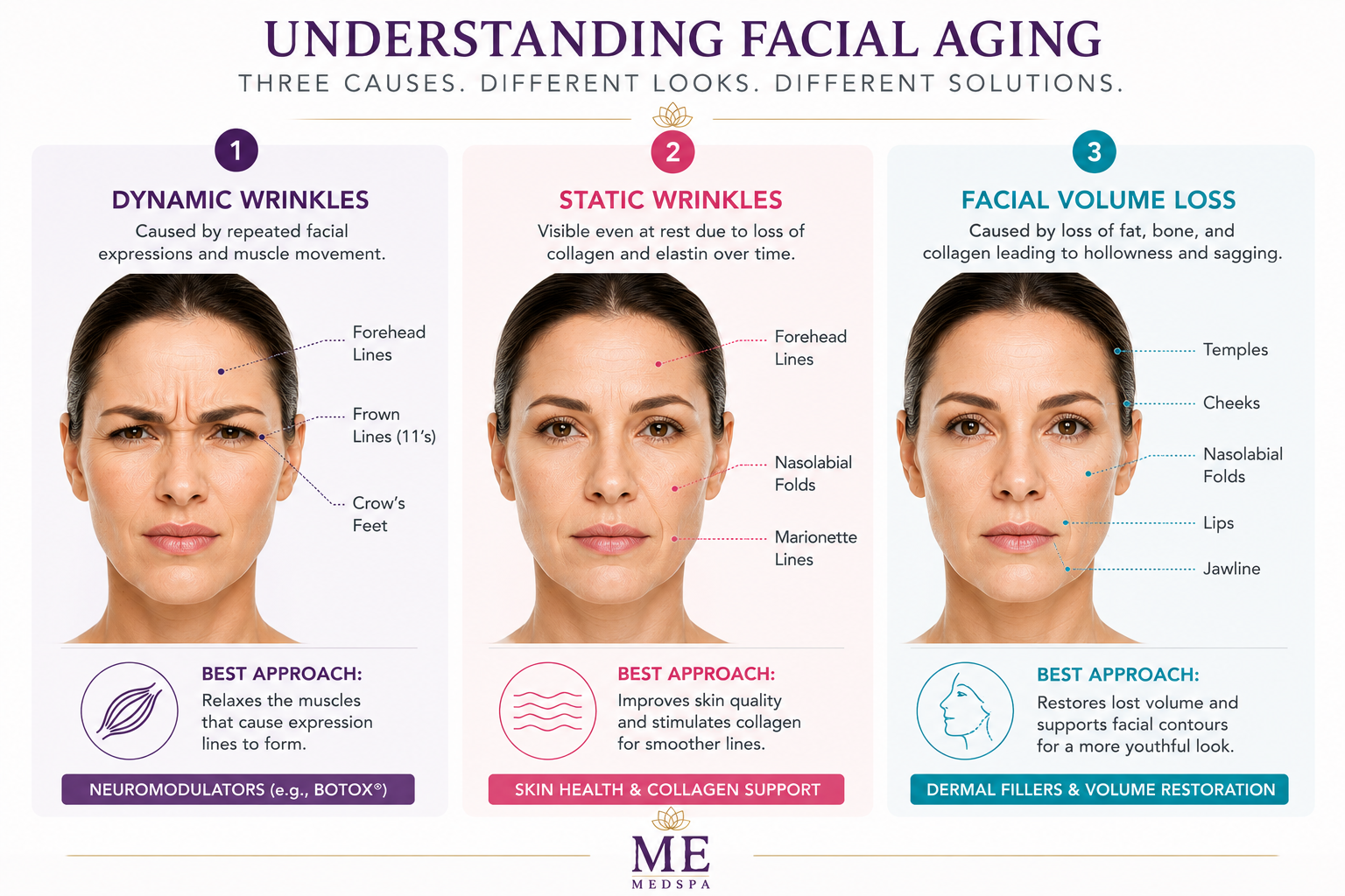 Comparison of dynamic wrinkles, static wrinkles, and age-related facial volume loss
