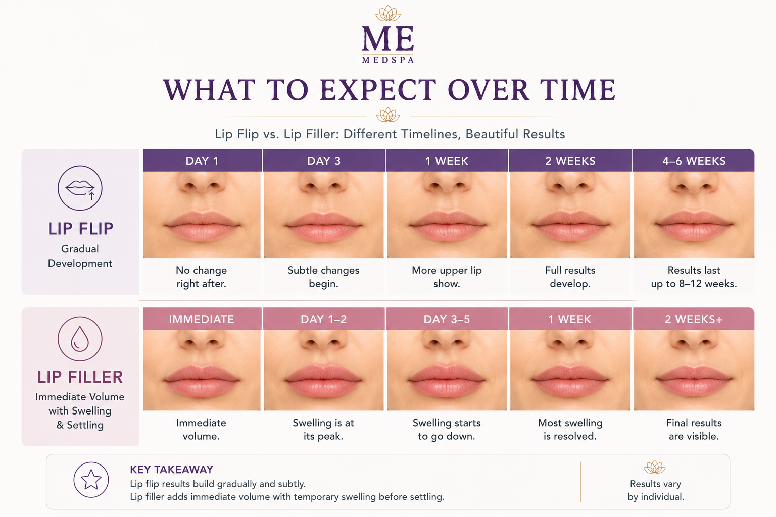 Timeline comparing how lip flip and lip filler results develop after treatment