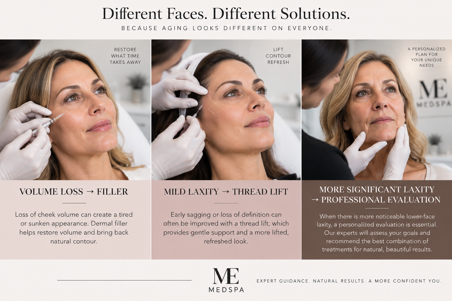  Different facial aging concerns showing dermal filler, thread lift, and professional evaluation as individualized treatment approaches