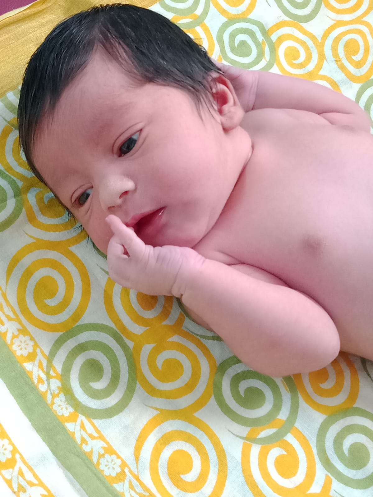 Ova IVF miracle baby